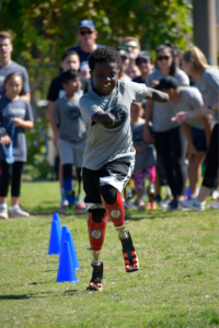 Chase running at Ossur clinic