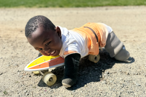 A smiling toddler with limb differences lies on a skateboard and pushes forward on a sandy path, wearing bright orange shorts and a white shirt.