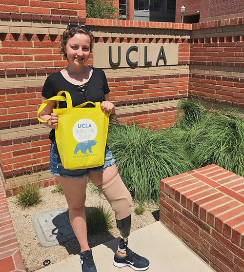 A young woman with a prosthetic leg stands in front of the UCLA sign holding a yellow UCLA Bruin Day tote bag.