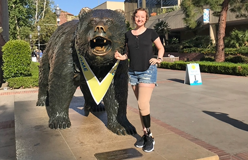 A young woman with a prosthetic leg poses next to the UCLA Bruin bear statue wearing a black shirt and denim shorts.