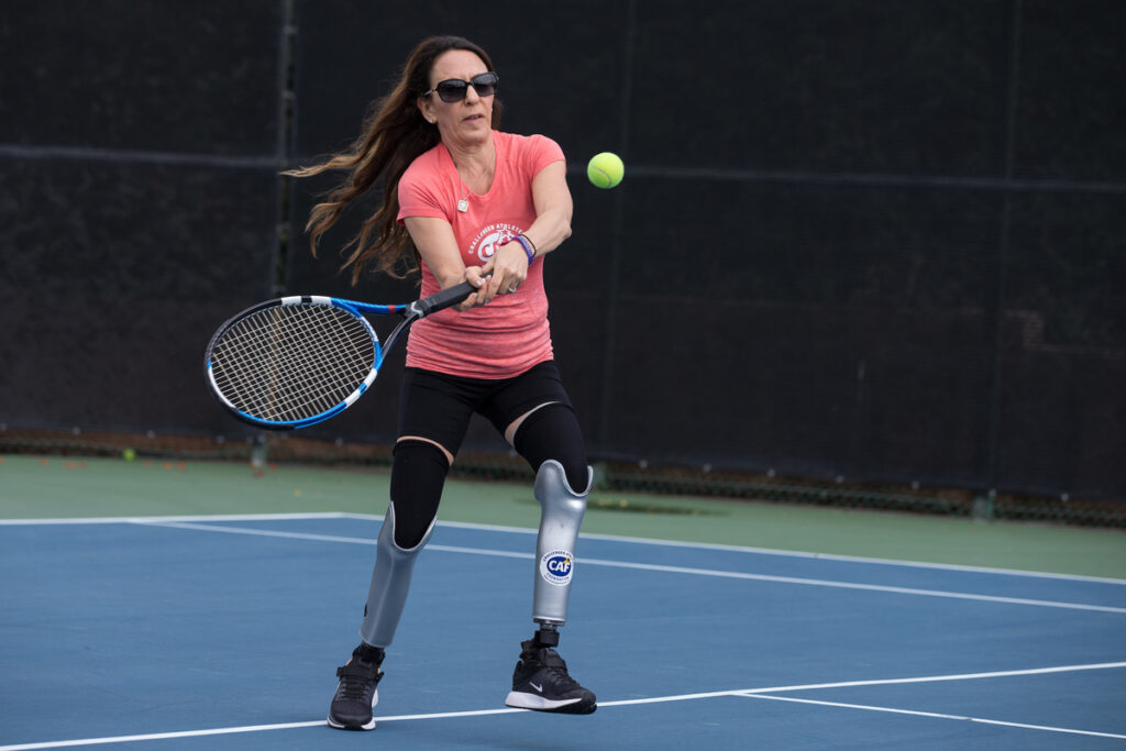 A person with prosthetic legs playing tennis on an outdoor court.
